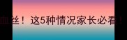 狗狗眼白突然冒红血丝这5种情况家长必看附家庭护理全攻略