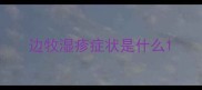 边牧湿疹症状是什么