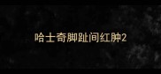 哈士奇脚趾间红肿
