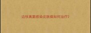 边牧真菌感染皮肤病如何治疗