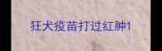 狂犬疫苗打过红肿