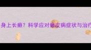 拉布拉多身上长癞科学应对癞皮病症状与治疗全指南