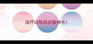 治疗边牧后皮肤掉毛