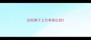 边牧鼻子上方有条红的