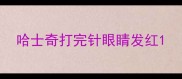 哈士奇打完针眼睛发红